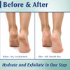 PEDIFIX FOOT CARE CALLUS CONTROL CREAM 092437331017 CALLUS CONTROL CREAM